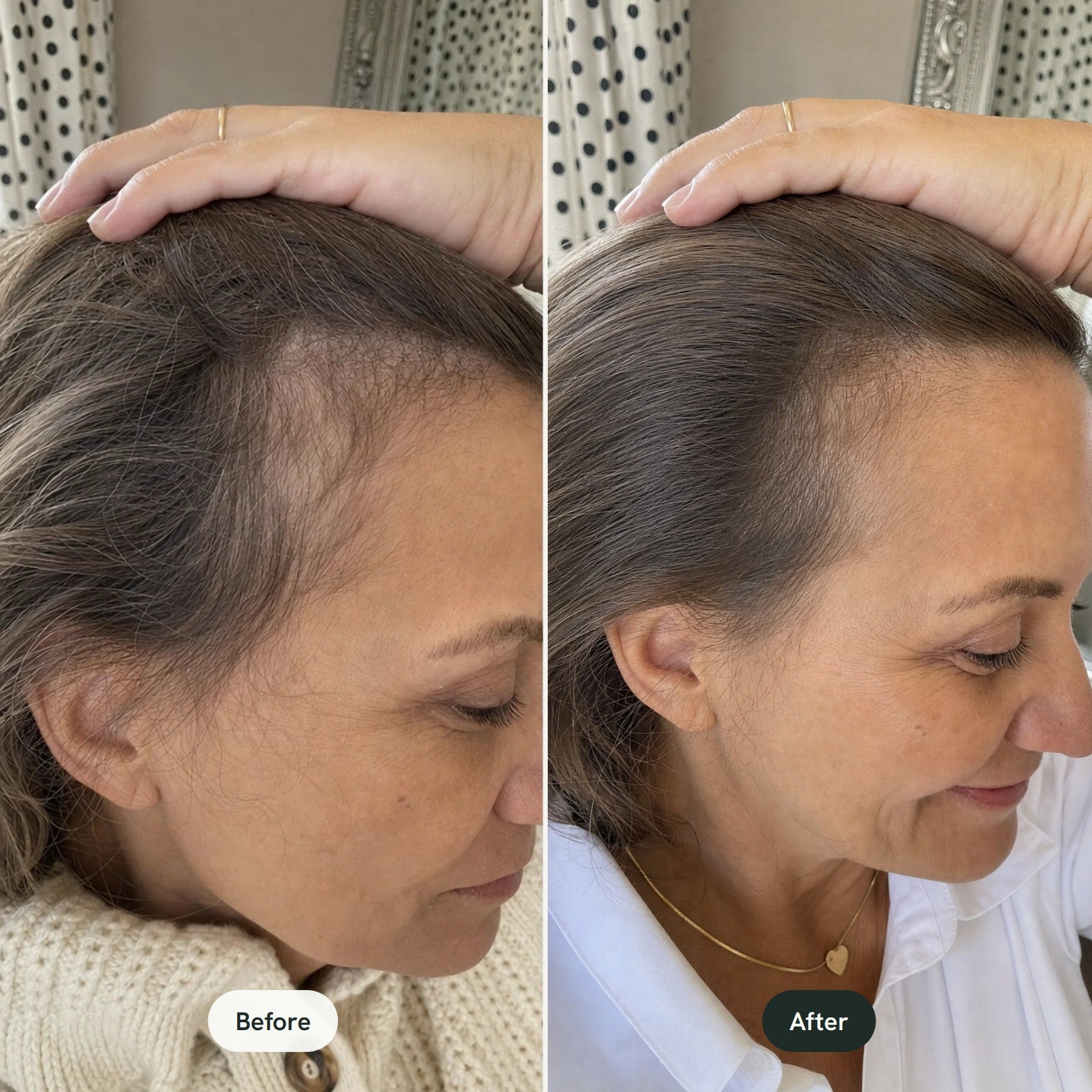 Before and after: smoother, shinier hair and a calm scalp at the hairline