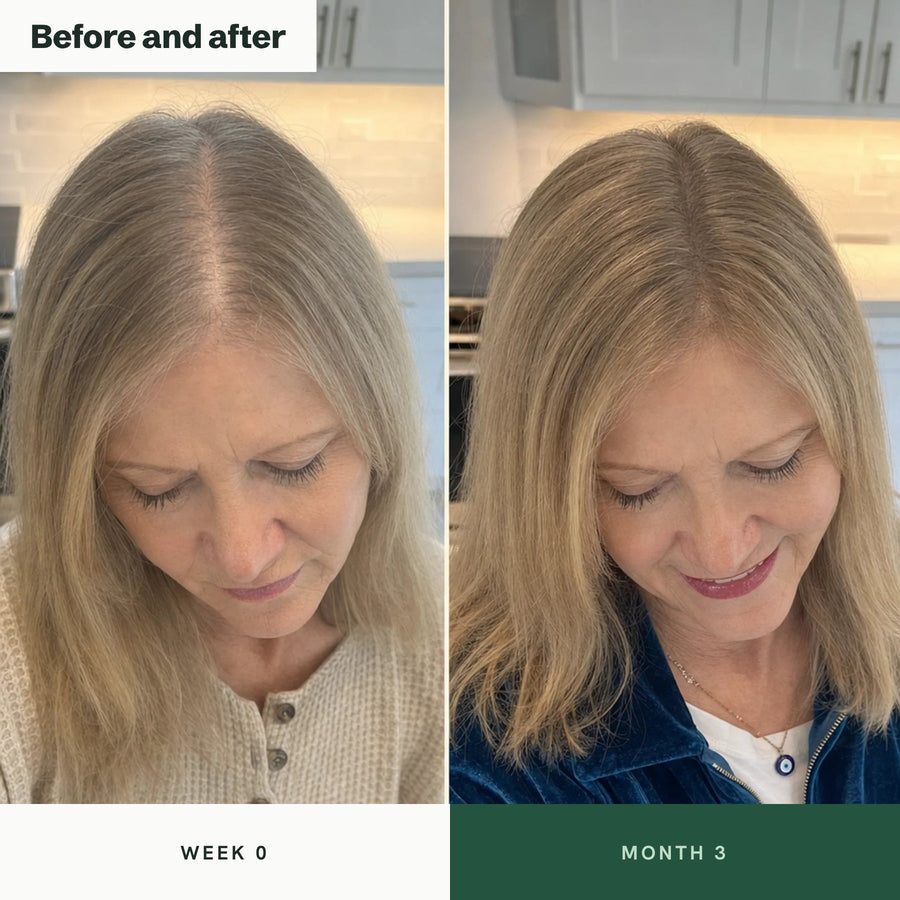 Before and after: parting at week 0 and month 3