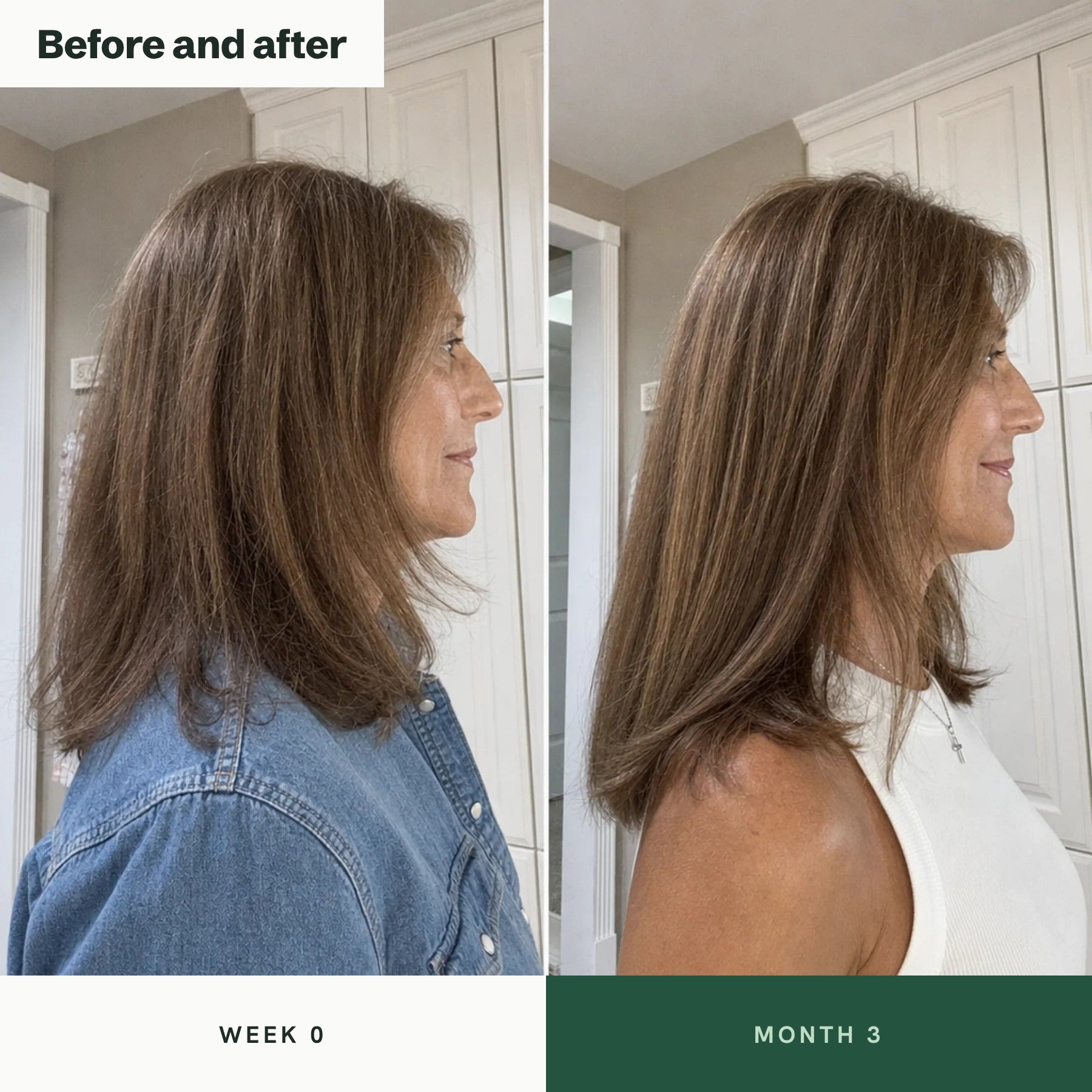 Before and after: length at week 0 and month 3