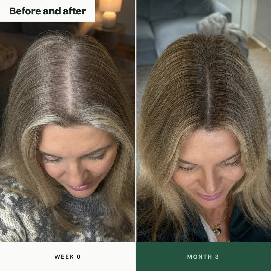 Before and after: parting seen from above at week 0 and month 3