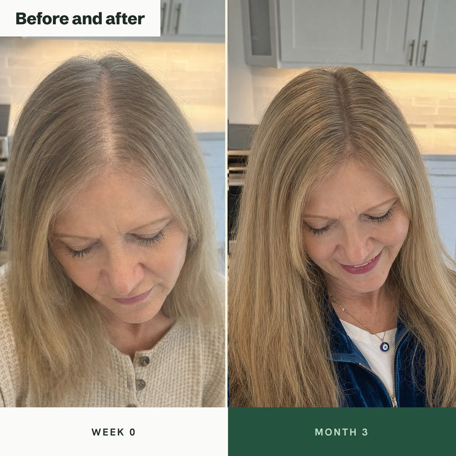 Before and after: parting at week 0 and month 3, hair grown past the shoulders