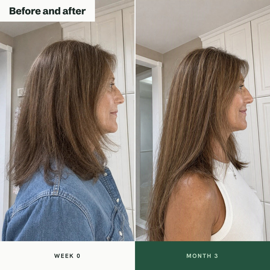 Before and after: length at week 0 and month 3, hair grown past the shoulders