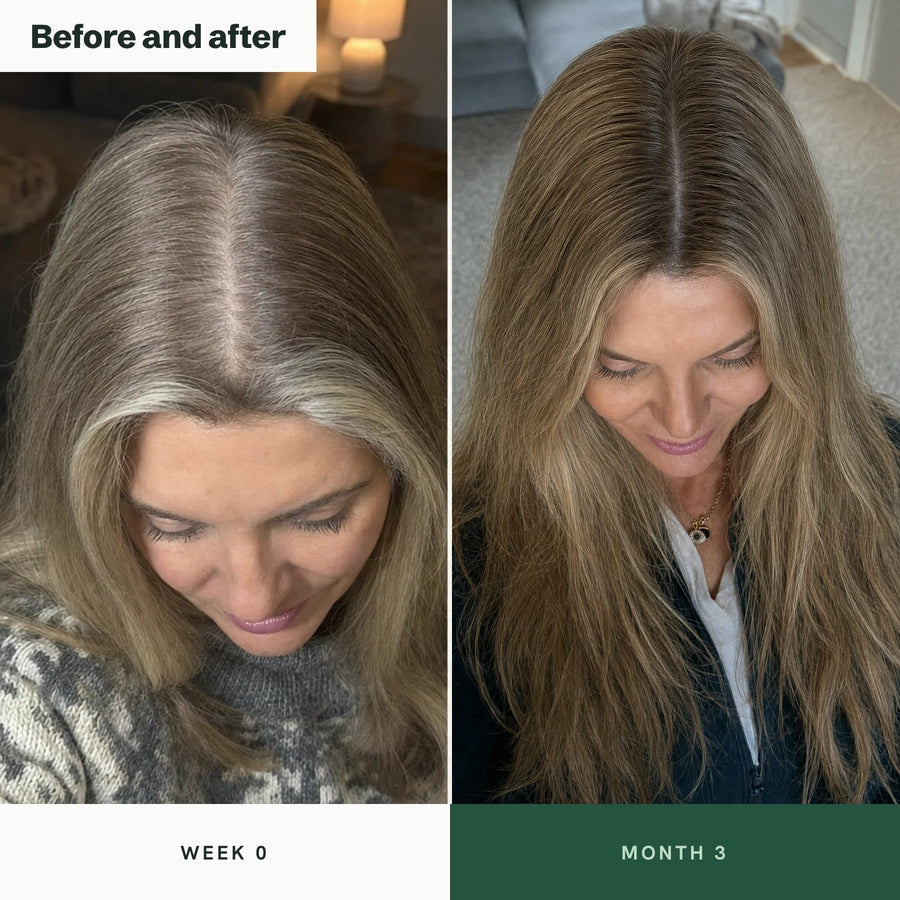 Before and after: parting seen from above at week 0 and month 3, hair grown past the shoulders